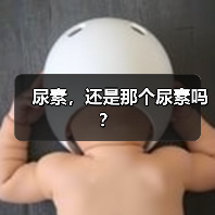 尿素,还是那个尿素吗?(图4) 尿素,还是那个尿素吗?(图4)